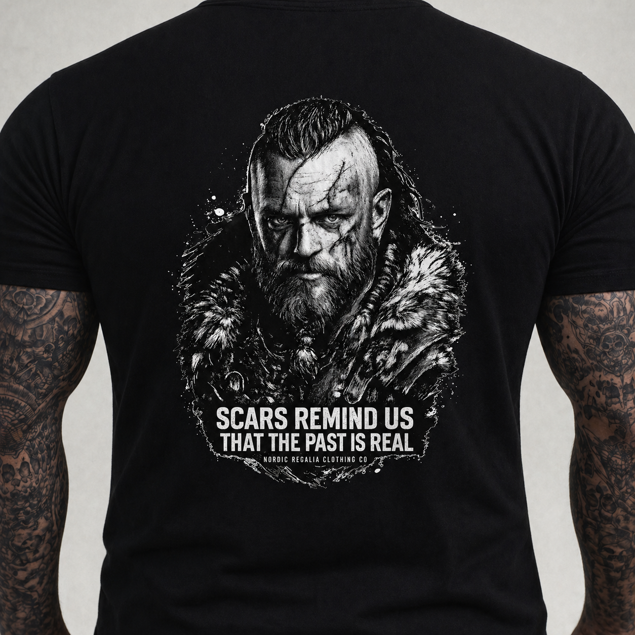 Scars